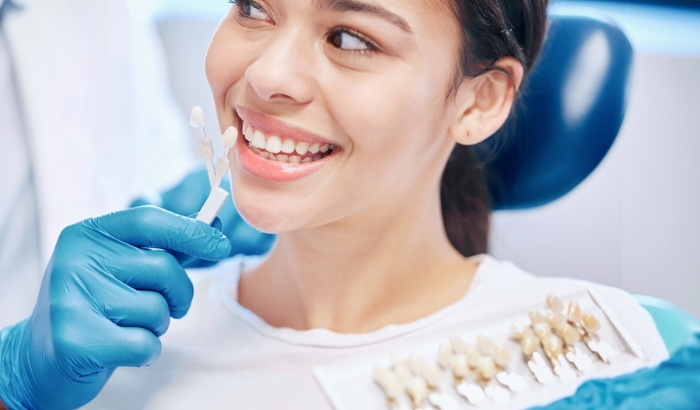 What’s the difference between a veneer and a crown