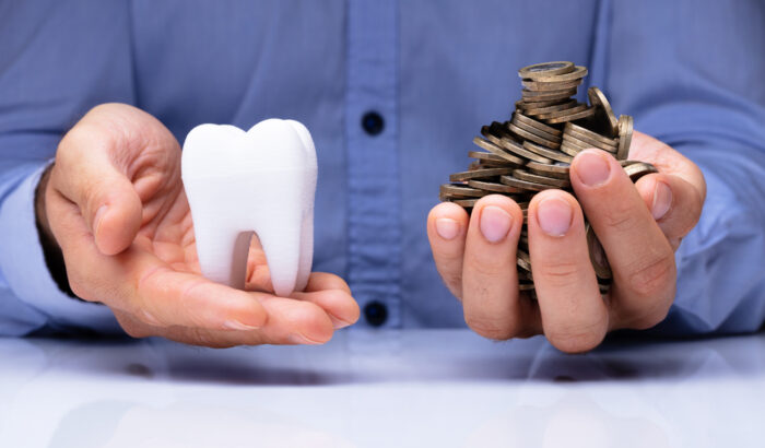 How much is a full set of veneers?