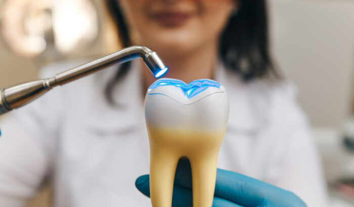 What is a tooth filling