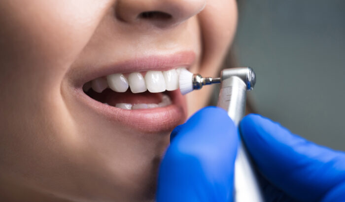 Subtle smile tweaks with cosmetic bonding – perfect for life’s big moments in Manchester