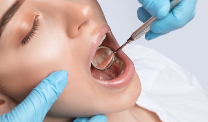 Can you get veneers with bad teeth