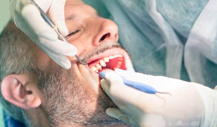 Which is more painful tooth extraction or filling