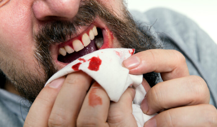 Things you should know about emergency dental care