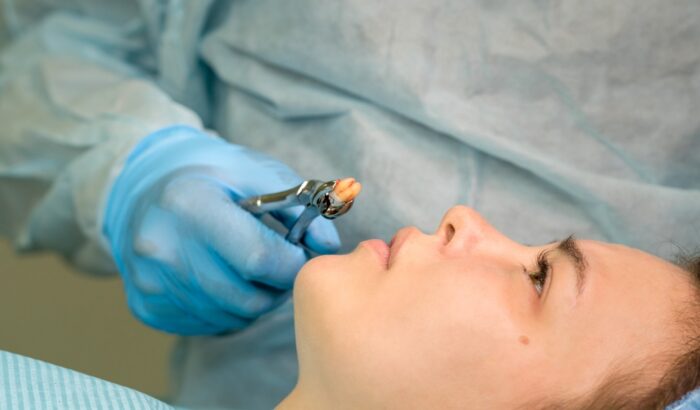 How to relieve tooth pain after filling