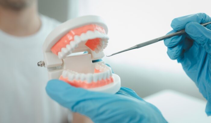 Dental implants vs dentures: choosing the right option in Bury