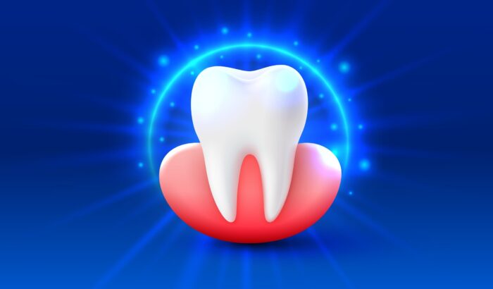 Protecting your socket after a tooth extraction: best practices