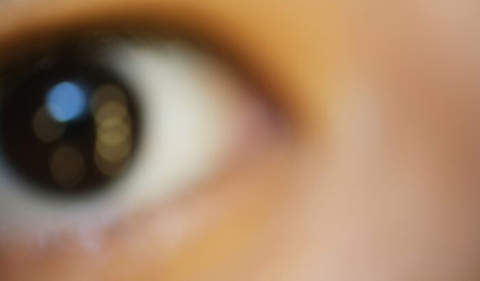 Do dry eyes cause blurry vision?