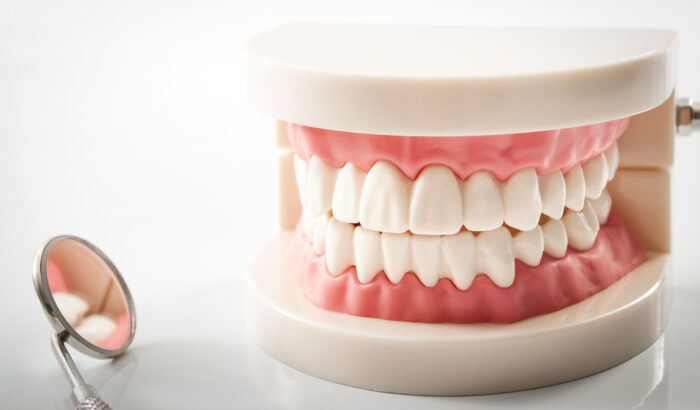 UK dental implants vs. dentures: which is right for you?