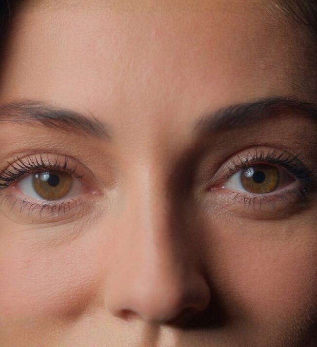 Chalazion Removal