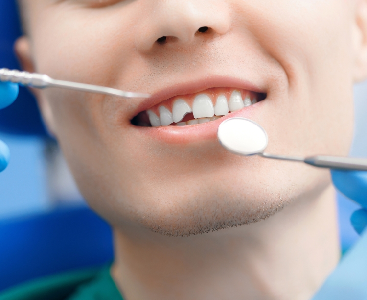 Broken teeth emergency