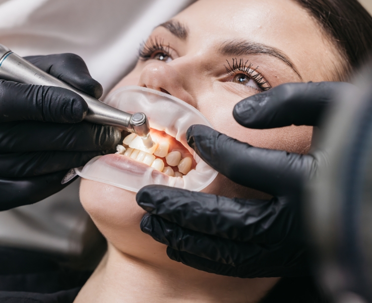 What is a dental hygienist?