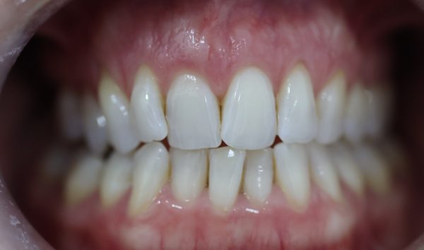 Before - Eye & Dental Clinic