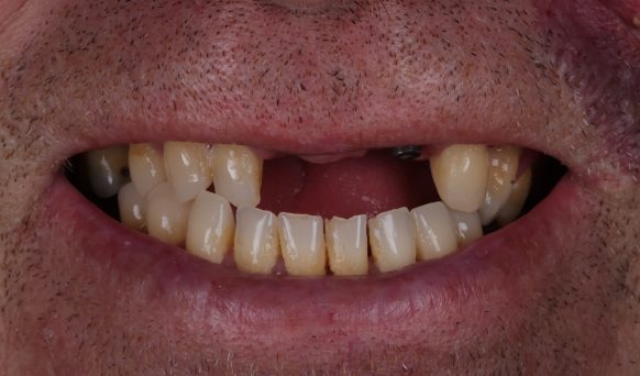 Before -Eye & Dental Clinic