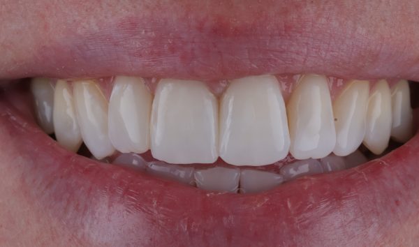After - Eye & Dental Clinic